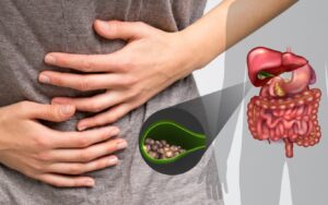 Common Lifestyle Habits That May Increase the Risk of Gall Stones